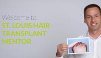 St. Louis Hair Transplant Mentor image 1